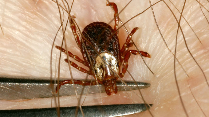 Female American dog tick being removed with tweezers