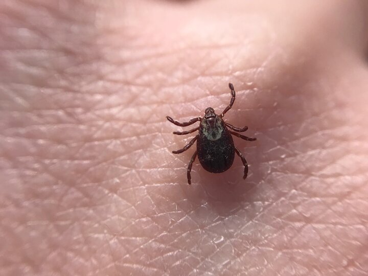 American Dog Tick crawling on hand